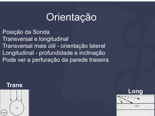 Orientação
Posição da Sonda
Transversal e longitudinal
Transversal mais útil - orientação lateral
Longitudinal - profundidade e inclinação
Pode ver a perfuração da parede traseira
Trans
Long
 
