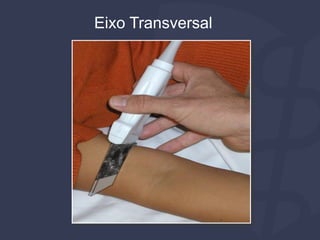 Eixo Transversal
 