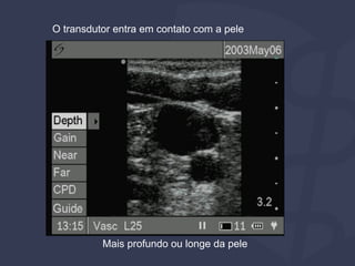 O transdutor entra em contato com a pele
Mais profundo ou longe da pele
 