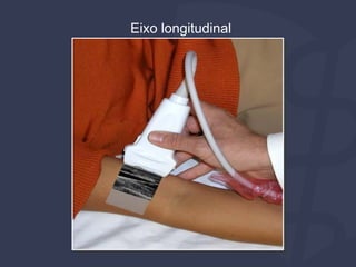 Eixo longitudinal
 