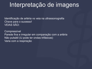 Interpretação de imagens
Identificação de artéria vs veia na ultrassonografia
Chave para o sucesso!
VEIAS SÃO:
Compressível
Parede fina e irregular em comparação com a artéria
Não pulsátil (IJ pode ter ondas trifásicas)
Varia com a respiração
 