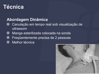 Abordagem Dinâmica
⦿ Canulação em tempo real sob visualização de
ultrassom
⦿ Manga esterilizada colocada na sonda
⦿ Freqüentemente precisa de 2 pessoas
⦿ Melhor técnica
Técnica
 