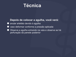 Depois de colocar a agulha, você verá:
⚫ anular artefato devido à agulha
⚫ vaso deformar conforme a pressão aplicada
⚫ Observe a agulha entrando na veia e observe se há
perfuração da parede posterior
Técnica
 