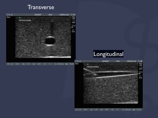 Longitudinal
Transverse
 