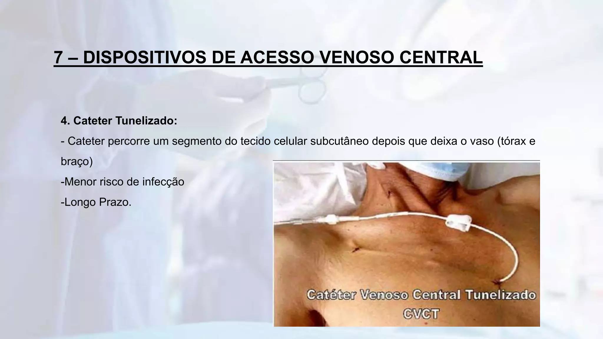 Acesso Venoso Central | PPTX