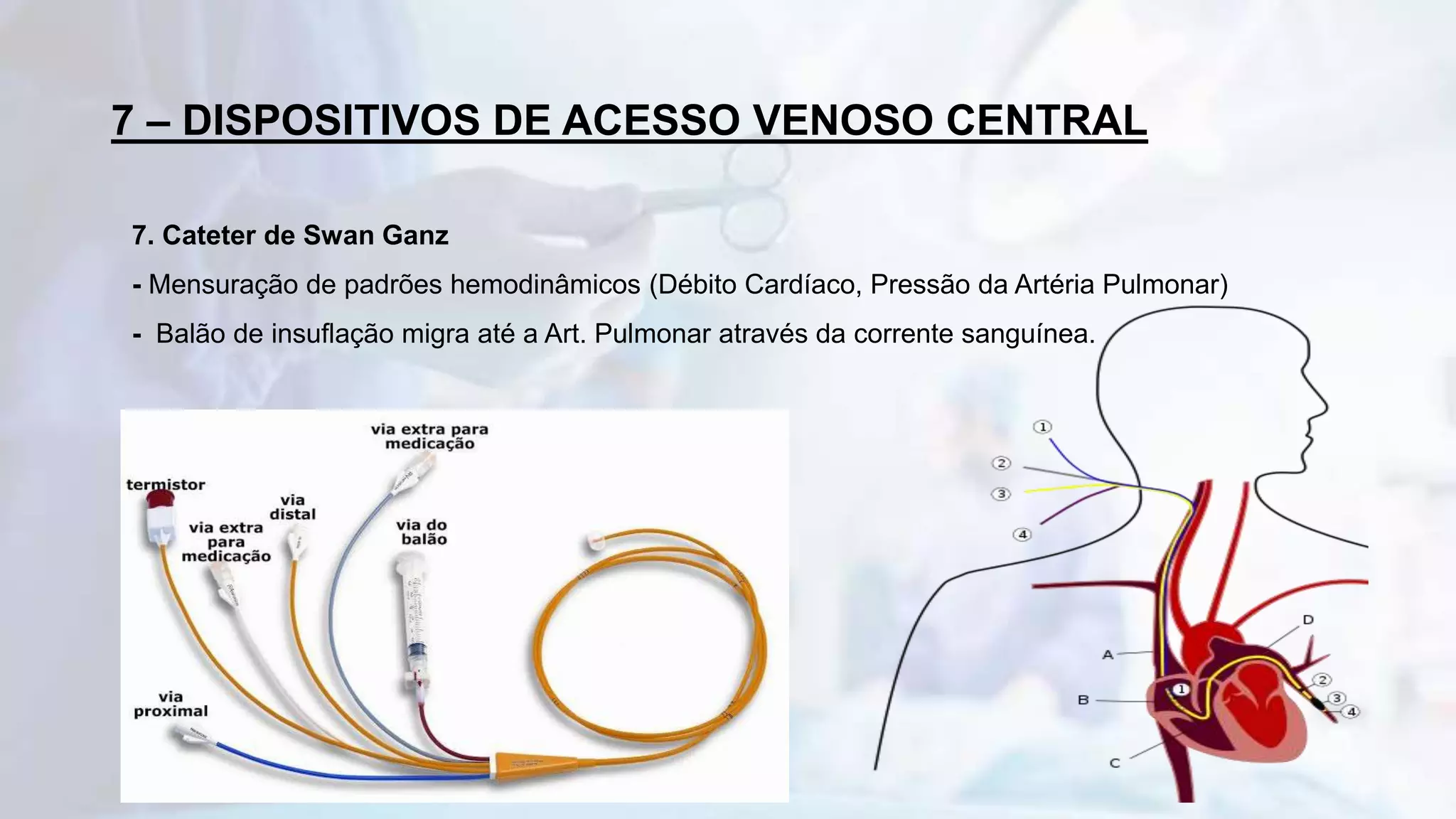 Acesso Venoso Central | PPTX