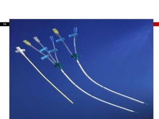 Mono ou Multiluminais
16
 