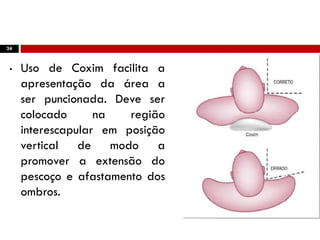 24
• Uso de Coxim facilita a
apresentação da área a
ser puncionada. Deve ser
colocado na região
interescapular em posição
vertical de modo a
promover a extensão do
pescoço e afastamento dos
ombros.
 