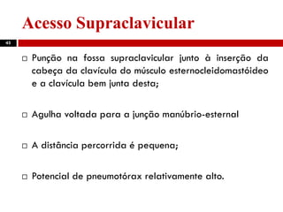 Acesso Supraclavicular
45
 Punção na fossa supraclavicular junto à inserção da
cabeça da clavícula do músculo esternocleidomastóideo
e a clavícula bem junta desta;
 Agulha voltada para a junção manúbrio-esternal
 A distância percorrida é pequena;
 Potencial de pneumotórax relativamente alto.
 
