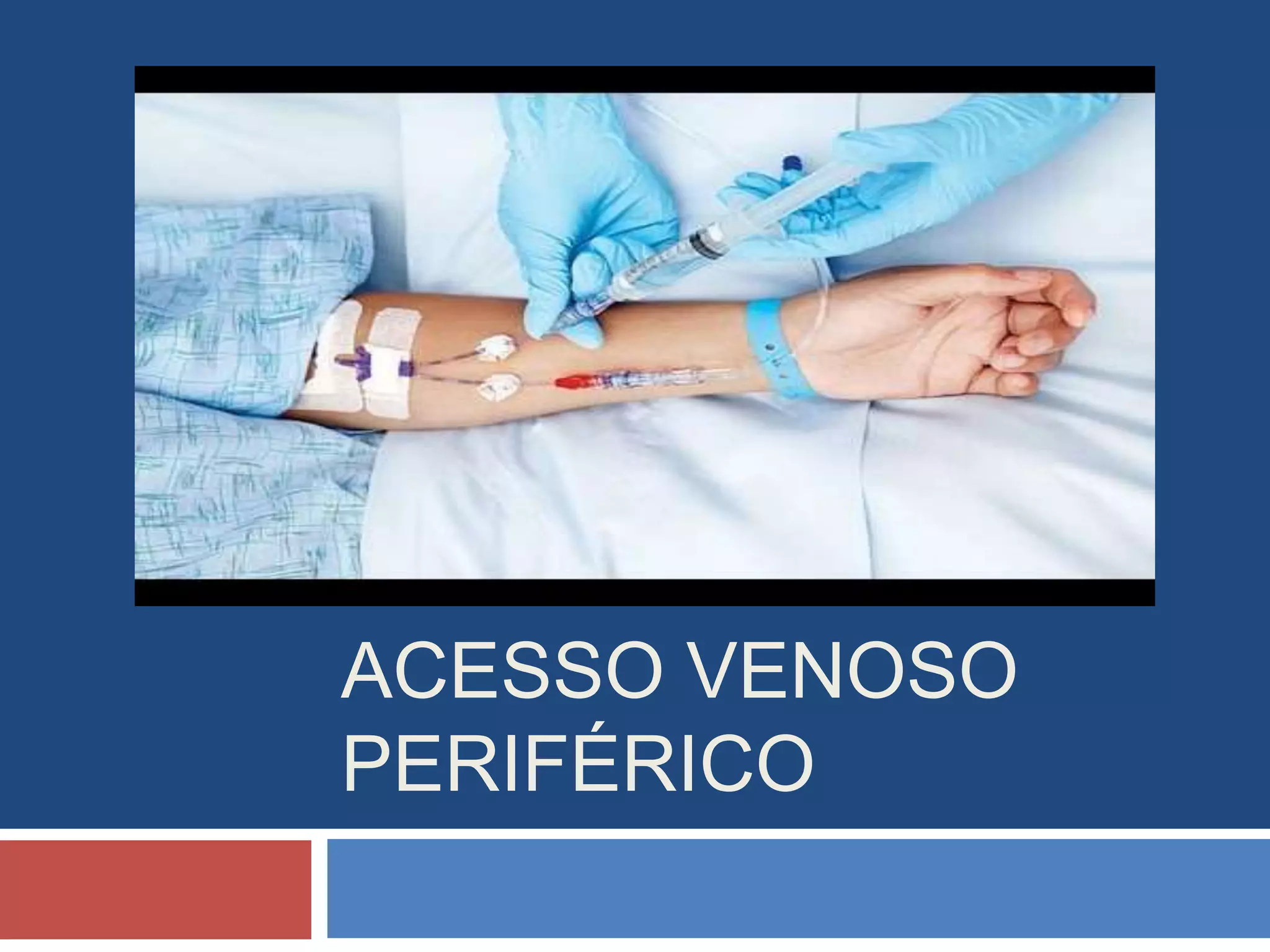 ACESSO_VENOSO_PERIFERICO_pront20190808-129308-1law2rc.pptx