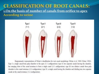 Weine Classification Access cavity ppt | PPTX