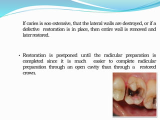 Access cavity ppt | PPTX