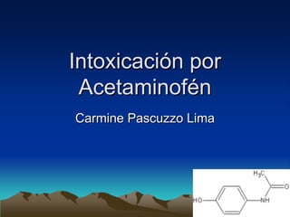 Intoxicación por
 Acetaminofén
Carmine Pascuzzo Lima
 