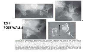 .
T.S #
POST WALL #
 