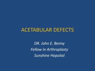 ACETABULAR DEFECTS
DR. John E. Benny
Fellow in Arthroplasty
Sunshine Hopsital
 