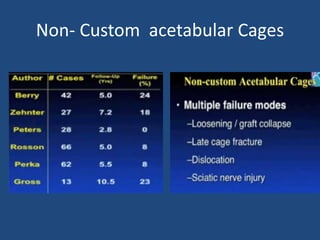 Non- Custom acetabular Cages
 