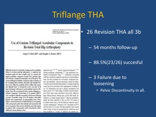Triflange THA
• 26 Revision THA all 3b
– 54 months follow-up
– 88.5%(23/26) succesful
– 3 Failure due to
loosening
• Pelvic Discontinuity in all.
 