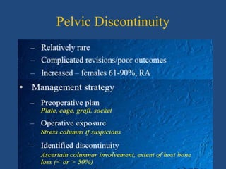 Pelvic Discontinuity
 