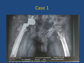 Case 1
 