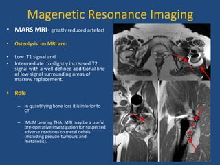 Magenetic Resonance Imaging
• MARS MRI- greatly reduced artefact
• Osteolysis on MRI are:
• Low T1 signal and
• Intermediate to slightly increased T2
signal with a well-defined additional line
of low signal surrounding areas of
marrow replacement.
• Role
– In quantifying bone loss it is inferior to
CT
– MoM bearing THA, MRI may be a useful
pre-operative investigation for suspected
adverse reactions to metal debris
(including pseudo-tumours and
metallosis).
 