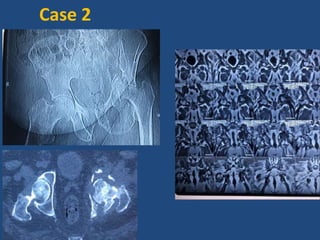 Case 2
 