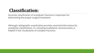 Acetabular | PPTX