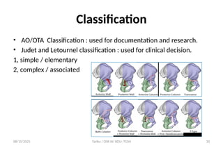 Jude Letournel Classification Acetabular fracture and managment option - Copy.pptx