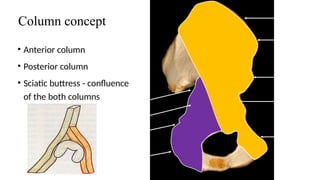 acetabularfractureppt4thsem-191025183803.pptx