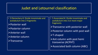 Jude Letournel Classification Acetabular fracture ppt 4th sem | PPTX