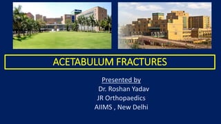 ACETABULUM FRACTURES
Presented by
Dr. Roshan Yadav
JR Orthopaedics
AIIMS , New Delhi
 