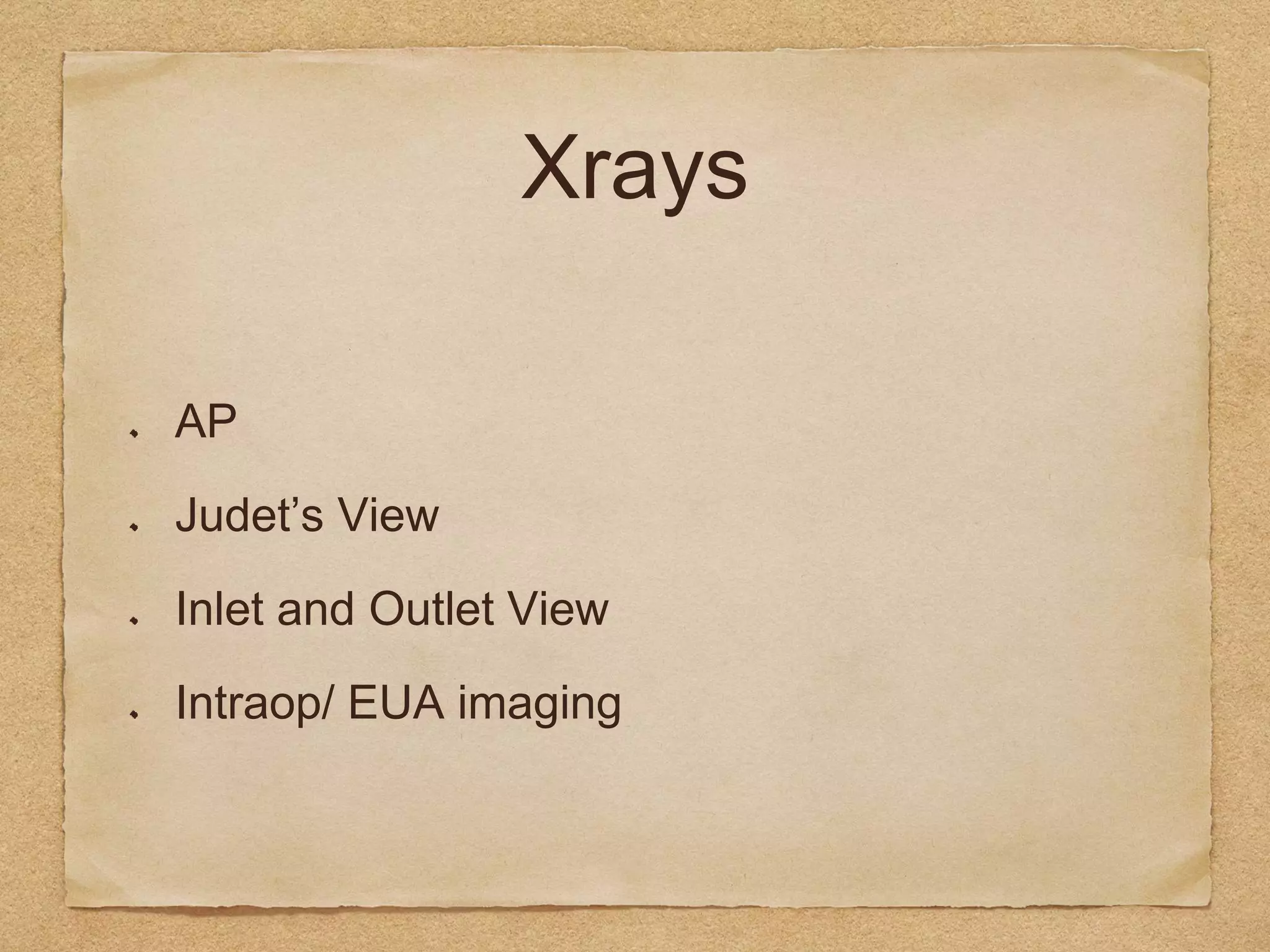 Acetabular Fracture Radiology: Xrays, CT scan & 3D printing | PPTX