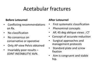 Letronel Classification Acetabular fractures | PPTX