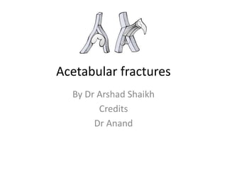Acetabular fractures
By Dr Arshad Shaikh
Credits
Dr Anand
 