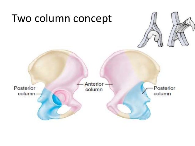acetabular fractures 13 638