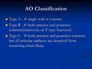Acetabular fractures.ppt