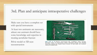 3rd. Plan and anticipate intraoperative challenges
Make sure you have a complete set
with special instruments
At least two assistants are necessary,
atleast one assistant should have
some knowledge and expertise in
treating acetabular fracture
Pelvic model or 3D scan
reconstruction
 