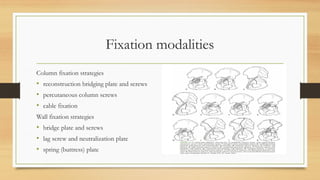 Fixation modalities
Column fixation strategies
• reconstruction bridging plate and screws
• percutaneous column screws
• cable fixation
Wall fixation strategies
• bridge plate and screws
• lag screw and neutralization plate
• spring (buttress) plate
 