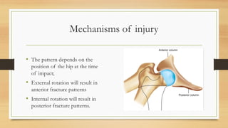 Mechanisms of injury
• The pattern depends on the
position of the hip at the time
of impact;
• External rotation will result in
anterior fracture patterns
• Internal rotation will result in
posterior fracture patterns.
 