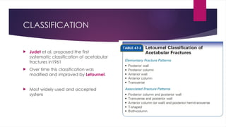 Jude Letournel Classification Acetabular fractures- Etiology , clinical features and management | PPTX