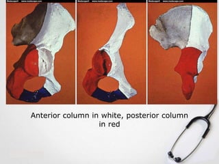 Anterior column in white, posterior column
in red

 