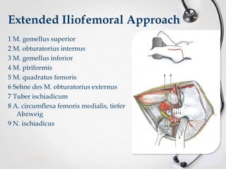 Extended Iliofemoral Approach
1 M. gemellus superior
2 M. obturatorius internus
3 M. gemellus inferior
4 M. piriformis
5 M. quadratus femoris
6 Sehne des M. obturatorius externus
7 Tuber ischiadicum
8 A. circumflexa femoris medialis, tiefer
Abzweig
9 N. ischiadicus

 