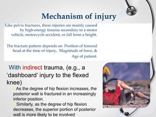 Mechanism of injury
Like pelvis fractures, these injuries are mainly caused
by high-energy trauma secondary to a motor
vehicle, motorcycle accident, or fall from a height.
The fracture pattern depends on Position of femoral
head at the time of injury, Magnitude of force, &
Age of patient.

With indirect trauma, (e.g., a
‘dashboard’ injury to the flexed
knee)
 As the degree of hip flexion increases, the
posterior wall is fractured in an increasingly
inferior position.
 Similarly, as the degree of hip flexion
decreases, the superior portion of posterior
wall is more likely to be involved

 