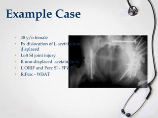 Example Case
• 48 y/o female
• Fx dislocation of L acetabulum displaced
• Left SI joint injury
• R non-displaced acetabular fx
• L:ORIF and Perc SI - FFWB
• R:Perc - WBAT

 