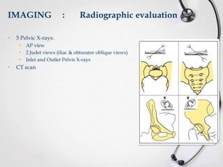 IMAGING
•

Radiographic evaluation

5 Pelvic X-rays:
•
•
•

•

:

AP view
2 Judet views (iliac & obturator oblique views)
Inlet and Outlet Pelvis X-rays

CT scan

 
