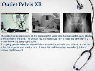 Outlet Pelvis XR

The patient is placed supine on the radiographic table with the midsagittal plane aligned
to the center of the grid. The central ray is directed 20 to 45 cephalic at the level 2
inches below the symphysis pubis.
A properly positioned outlet view will demonstrate the superior and inferior rami of the
pubis the superior and inferior rami of the pubis and the ischia, sacroiliac joint and
vertical displacement

 