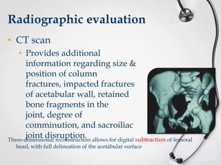 Radiographic evaluation
• CT scan
• Provides additional
information regarding size &
position of column
fractures, impacted fractures
of acetabular wall, retained
bone fragments in the
joint, degree of
comminution, and sacroiliac
joint disruption.
Three-dimensional reconstruction allows for digital subtraction of femoral
head, with full delineation of the acetabular surface

 