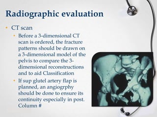 Radiographic evaluation
• CT scan
• Before a 3-dimensional CT
scan is ordered, the fracture
patterns should be drawn on
a 3-dimensional model of the
pelvis to compare the 3dimensional reconstructions
and to aid Classification
• If sup glutel artery flap is
planned, an angiogrphy
should be done to ensure its
continuity especially in post.
Column #

 