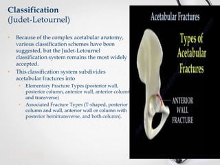 Classification
(Judet-Letournel)
•

•

Because of the complex acetabular anatomy,
various classification schemes have been
suggested, but the Judet-Letournel
classification system remains the most widely
accepted.
This classification system subdivides
acetabular fractures into
•

•

Elementary Fracture Types (posterior wall,
posterior column, anterior wall, anterior column
and transverse)
Associated Fracture Types (T-shaped, posterior
column and wall, anterior wall or column with
posterior hemitransverse, and both column).

 