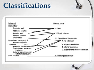 Classifications

 