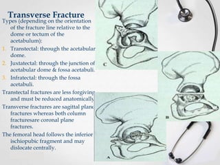 Transverse Fracture

Types (depending on the orientation
of the fracture line relative to the
dome or tectum of the
acetabulum):
1. Transtectal: through the acetabular
dome.
2. Juxtatectal: through the junction of
acetabular dome & fossa acetabuli.
3. Infratectal: through the fossa
acetabuli.
Transtectal fractures are less forgiving
and must be reduced anatomically.
Transverse fractures are sagittal plane
fractures whereas both column
fracturesare coronal plane
fractures.
The femoral head follows the inferior
ischiopubic fragment and may
dislocate centrally.

 